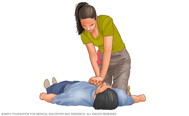 What Should You Not Do During CPR?